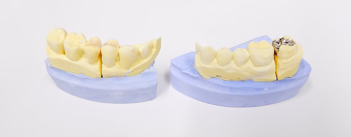 青い光で樹脂を固める様子