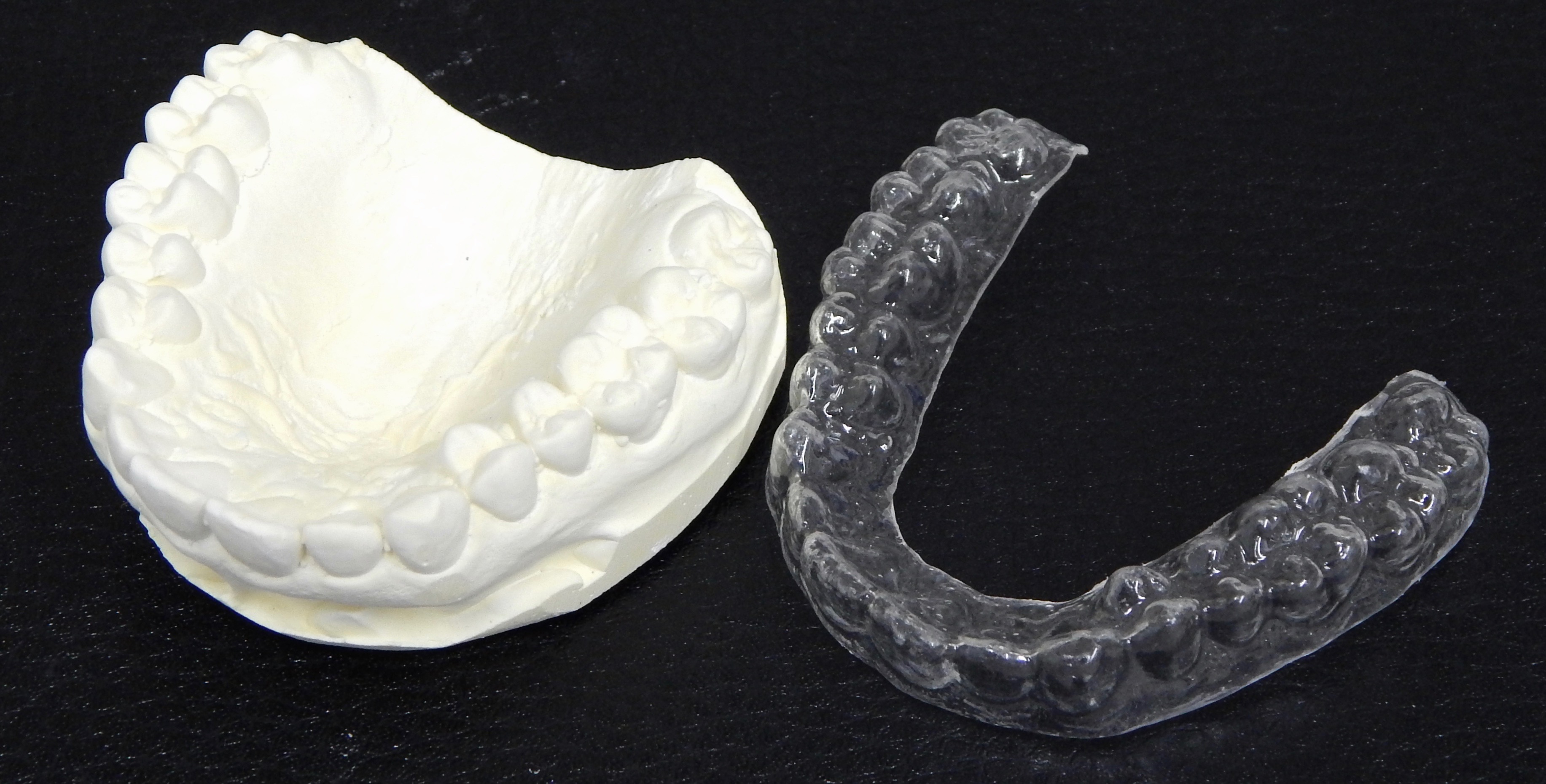 マウスピース矯正