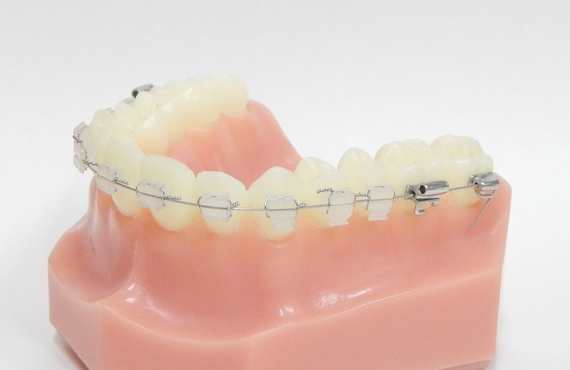 ワイヤーブラケット