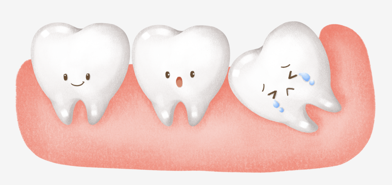親知らず抜歯症例